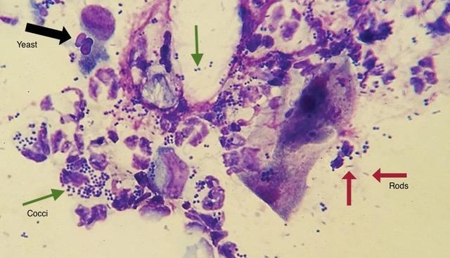 Ear Infections/Cytology